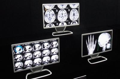 JOLED 21.6'' 4K oled medical monitor prototypes photo