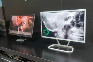 JOLED medical and ASUS OLED monitor prototype (FineTech Japan 2018)